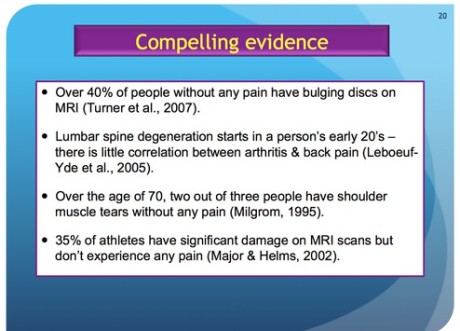 Osteoarthritis-460x331