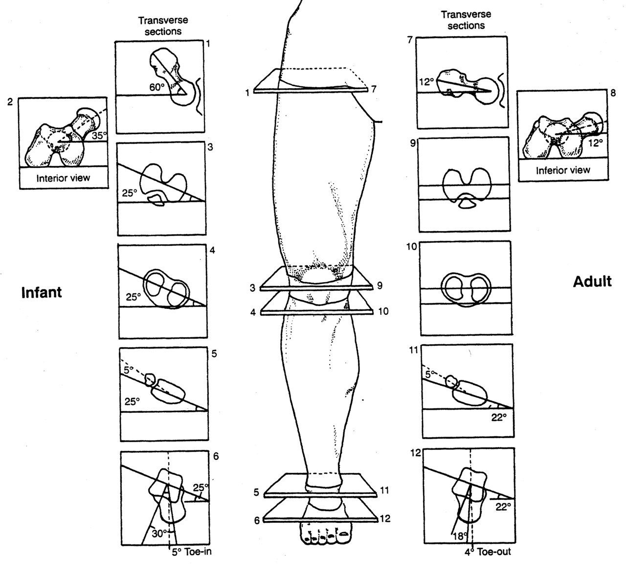 Torcel Leg Torsions & Versions | JC Physiotherapy
